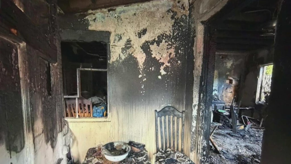 Woman hospitalized after Miami house fire leaves three displaced — CBS Miami, Beijing Health news